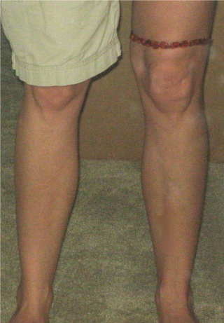 <u>Polished Honey<br>For Knee Discomfort</u>