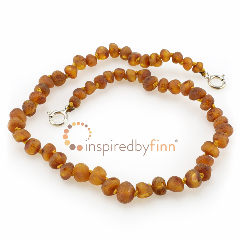 <u>Baltic Amber Anklet - Adjustable<br></u>Unpolished Cider