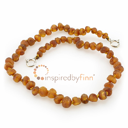 <u>Baltic Amber Anklet - Adjustable<br></u>Unpolished Cider
