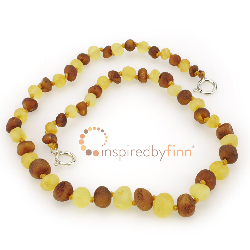 <u>Baltic Amber Anklet - Adjustable<br></u>Unpolished Mixture
